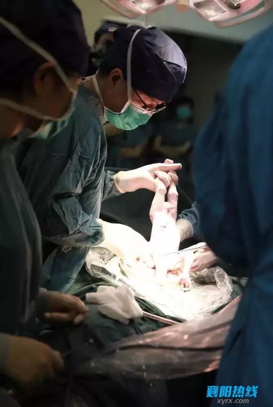 中国首例添宫宝宝出生,母亲将子宫移植给女儿!网友:男人生娃指日可待!